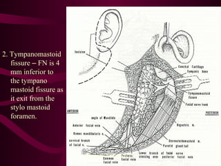 2. Tympanomastoid
fissure – FN is 4
mm inferior to
the tympano
mastoid fissure as
it exit from the
stylo mastoid
foramen.
sumeryadav2004@gmail.com
 