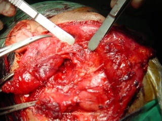 sumeryadav2004@gmail.com
 