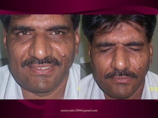 sumeryadav2004@gmail.com
 