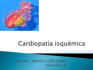 Presenta : BRENDA LOPEZ PARRA
Informática III
 