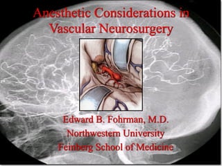 Anesthetic Considerations in
Vascular Neurosurgery
Edward B. Fohrman, M.D.
Northwestern University
Feinberg School of Medicine
 