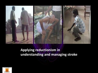 Applying reductionism in
understanding and managing stroke
 