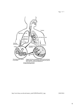 Page  1  of  1




http://www.bissy.scot.nhs.uk/master_code/COPD/Pilsinl/I62_L.jpg   28/02/2010




                                                                                   1
 