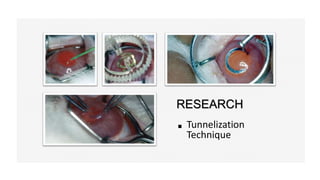 RESEARCH
Tunnelization
Technique
 