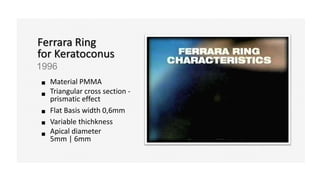 Ferrara Ring
for Keratoconus
1996
Material PMMA
Triangular cross section -
prismatic effect
Flat Basis width 0,6mm
Variable thichkness
Apical diameter
5mm | 6mm
 