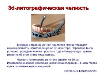 3d-литографическая челюсть




       Впервые в мире 83-летней пациентке имплантировали
нижнюю челюсть, изготовленную на 3D-принтере. Пересадка была
успешно проведена в июне прошлого года в Нидерландах, однако
известно об этом стало лишь сейчас.
       Челюсть изготовлена из титана слоями по 30 мк.
Изготовление заняло несколько часов; сама операция – 4 часа. Через
4 дня пациентка вернулась домой.
                                         Top.rbc.ru, 8 февраля 2012 г.
 