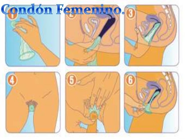 Sobre los muchachos con un pequeño miembro