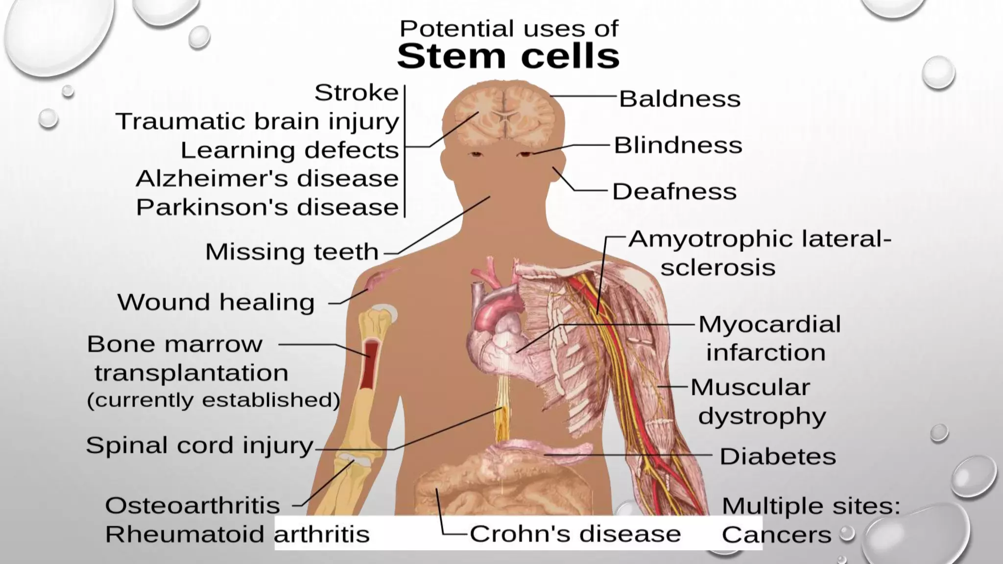 STEMCELL