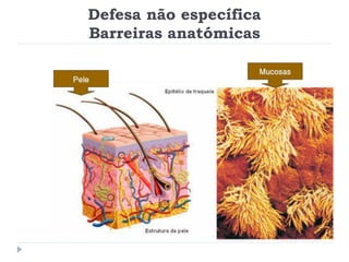 Defesa não específica
Barreiras anatómicas
 