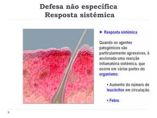 Defesa não específica
 Resposta sistémica
 