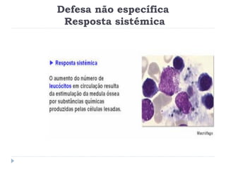 Defesa não específica
 Resposta sistémica
 