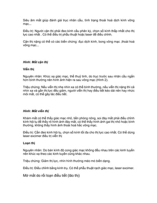 Siêu âm mắt giúp đánh giá trục nhãn cầu, tình trạng thoái hoá dịch kính võng
mạc...
Điều trị: Người cận thị phải đeo kính cầu phân kỳ, chọn số kính thấp nhất cho thị
lực cao nhất . Có thể điều trị phẫu thuật hoặc laser để điều chỉnh.
Cận thị nặng có thể có các biến chứng: đục dịch kính, bong võng mạc ,thoái hoá
võng mạc...
Hình: Mắt cận thị
Viễn thị
Nguyên nhân: Khúc xạ giác mạc, thể thuỷ tinh, do trục trước sau nhãn cầu ngắn
hơn bình thường nên hình ảnh hiện ra sau võng mạc (Hình 2).
Triệu chứng: Nếu viễn thị nhẹ nhìn xa có thể bình thường, nếu viễn thị nặng thì cả
nhìn xa và gần thị lực đều giảm, người viễn thị hay điều tiết kéo dài nên hay nhức
mỏi mắt, có thể gây lác điều tiết.
Hình: Mắt viễn thị
Khám mắt có thể thấy giác mạc nhỏ, tiền phòng nông, soi đáy mắt phải điều chỉnh
kính hội tụ để thấy rõ hình ảnh đáy mắt, có thể thấy hình ảnh gai thị nhỏ hoặc bình
thường, không thấy hình ảnh thoái hoá hắc võng mạc.
Điều trị: Cần đeo kính hội tụ, chọn số kính tối đa cho thị lực cao nhất. Có thể dùng
laser excimer điều trị viễn thị
Loạn thị
Nguyên nhân: Do bán kính độ cong giác mạc không đều nhau trên các kinh tuyến
nên khúc xạ theo các kinh tuyến cũng khác nhau.
Triệu chứng: Giảm thị lực, nhìn hình thường méo mó biến dạng.
Điều trị: Điều chỉnh bằng kính trụ. Có thể phẫu thuật rạch giác mạc, laser excimer.
Mờ mắt do rối loạn điều tiết (lão thị)
 