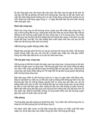 Dị vật nông giác mạc cần được lấy một cách cẩn thận sau khi gây tê bề mặt. Dị
vật sâu nên lấy tại phòng mổ dưới kính phóng đại. Sau lấy dị vật cần chăm sóc
mắt cẩn thận bằng thuốc kháng sinh và các thuốc tăng cường dinh dưỡng tra tại
chỗ. Khám lại mắt hàng ngày trong 3 – 5 ngày để phát hiện kịp thời biến chứng
viêm loét giác mạc.
Rách lớp củng mạc
Rách lớp củng mạc là vết thương chưa xuyên qua hết chiều dày củng mạc. Vì
vậy ít ảnh hưởng đến thị lực, không làm thay đổi nhãn áp và khi khám đáy mắt sẽ
không có tổn thương xuất huyết và rách võng mạc ở vị trí tương ứng. Tuy nhiên
tổn thương này thường rất khó khẳng định khi khám lâm sàng vì vết rách và xuất
huyết kết mạc che lấp. Chỉ nên khẳng định chẩn đoán trên bàn mổ sau khi đã
thăm dò vết thương một cách kỹ lưỡng.
Vết thương xuyên thủng nhãn cầu
Ngoài hậu quả gây phòi tổ chức do áp lực dương tính trong nội nhãn, vết thương
xuyên thủng nhãn cầu còn mở cửa để vi khuẩn xâm nhập vào mắt gây nhiễm
trùng nội nhãn đặc biệt là khi có dị vật nội nhãn kèm theo.
Tổn hại giác mạc, củng mạc
Vết thương có thể đơn thuần trên giác mạc hay củng mạc, nhưng cũng có khi kéo
dài trên cả giác mạc và củng mạc. Vết thương giác mạc cần được khâu lại bằng
chỉ nylon 10/0. Hậu quả để lại là loạn thị không đều do sẹo giác mạc. Vết thương
củng mạc cần được khâu bằng chỉ 7/0 hoặc 8/0 rồi áp lạnh xung quanh đề phòng
biến chứng bong võng mạc.
Đặc biệt nguy hiểm là vết thương vùng rìa vì nguy cơ gây viêm mắt đồng cảm.
Đây là một bệnh tự miễn do cơ thể sản xuất ra kháng thể chống lại thể mi do vết
thương làm bộc lộ những kháng nguyên thể mi chưa bao giờ tiếp xúc với hệ
thống miễn dịch của cơ thể. Các kháng thể này lưu hành trong máu và sẽ chống
lại thể mi của mắt lành gây viêm màng bồ đào cho mắt không bị chấn thương.
Bệnh tiến triển từng đợt hậu quả cuối cùng là dính mống mắt, đục thể thủy tinh và
teo nhãn cầu. Đây là một biến chứng vô cùng thảm khốc của vết thương xuyên
gây hậu quả mù hoàn toàn cả hai mắt.
Tiền phòng
Thường thấy xẹp tiền phòng do thoát thủy dịch. Tuy nhiên nếu vết thương nhỏ, tự
khép kín thì tiền phòng vẫn có thể được duy trì.
Khi bệnh nhân đến muộn có thể thấy trong tiền phòng có nhiều xuất tiết hoặc
ngấn mủ. Đó là dấu hiệu của nhiễm trùng nội nhãn, tiên lượng rất nặng.
 