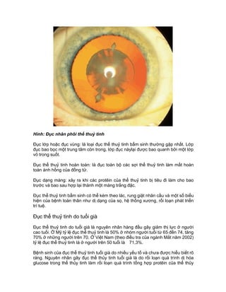 Hình: Đục nhân phôi thể thuỷ tinh
Đục lớp hoặc đục vùng: là loại đục thể thuỷ tinh bẩm sinh thường gặp nhất. Lớp
đục bao bọc một trung tâm còn trong, lớp đục nàylại được bao quanh bởi một lớp
vỏ trong suốt.
Đục thể thuỷ tinh hoàn toàn: là đục toàn bộ các sợi thể thuỷ tinh làm mất hoàn
toàn ánh hồng của đồng tử.
Đục dạng màng: xảy ra khi các protêin của thể thuỷ tinh bị tiêu đi làm cho bao
trước và bao sau hợp lại thành một màng trắng đặc.
Đục thể thuỷ tinh bẩm sinh có thể kèm theo lác, rung giật nhãn cầu và một số biểu
hiện của bệnh toàn thân như dị dạng của sọ, hệ thống xương, rối loạn phát triển
trí tuệ.
Đục thể thuỷ tinh do tuổi già
Đục thể thuỷ tinh do tuổi già là nguyên nhân hàng đầu gây giảm thị lực ở người
cao tuổi. Ở Mỹ tỷ lệ đục thể thuỷ tinh là 50% ở nhóm người tuổi từ 65 đến 74, tăng
70% ở những người trên 70. Ở Việt Nam (theo điều tra của ngành Mắt năm 2002)
tỷ lệ đục thể thuỷ tinh là ở người trên 50 tuổi là 71,3%.
Bệnh sinh của đục thể thuỷ tinh tuổi già do nhiều yếu tố và chưa được hiểu biết rõ
ràng. Nguyên nhân gây đục thể thủy tinh tuổi già là do rối loạn quá trình dị hóa
glucose trong thể thủy tinh làm rối loạn quá trình tổng hợp protêin của thể thủy
 