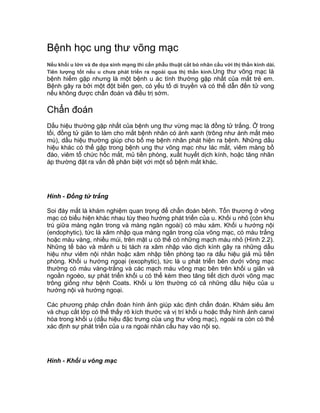 Bệnh học ung thư võng mạc
Nếu khối u lớn và đe dọa sinh mạng thì cần phẫu thuật cắt bỏ nhãn cầu với thị thần kinh dài.
Tiên lượng tốt nếu u chưa phát triển ra ngoài qua thị thần kinh.Ung thư võng mạc là
bệnh hiếm gặp nhưng là một bệnh u ác tính thường gặp nhất của mắt trẻ em.
Bệnh gây ra bởi một đột biến gen, có yếu tố di truyền và có thể dẫn đến tử vong
nếu không được chẩn đoán và điều trị sớm.
Chẩn đoán
Dấu hiệu thường gặp nhất của bệnh ung thư vừng mạc là đồng tử trắng. Ở trong
tối, đồng tử giãn to làm cho mắt bệnh nhân có ánh xanh (trông như ánh mắt mèo
mù), dấu hiệu thường giúp cho bố mẹ bệnh nhân phát hiện ra bệnh. Những dấu
hiệu khác có thể gặp trong bệnh ung thư võng mạc như lác mắt, viêm màng bồ
đào, viêm tổ chức hốc mắt, mủ tiền phòng, xuất huyết dịch kính, hoặc tăng nhãn
áp thường đặt ra vấn đề phân biệt với một số bệnh mắt khác.
Hình - Đồng tử trắng
Soi đáy mắt là khám nghiệm quan trọng để chẩn đoán bệnh. Tổn thương ở võng
mạc có biểu hiện khác nhau tùy theo hướng phát triển của u. Khối u nhỏ (còn khu
trú giữa màng ngăn trong và màng ngăn ngoài) có màu xám. Khối u hướng nội
(endophytic), tức là xâm nhập qua màng ngăn trong của võng mạc, có màu trắng
hoặc màu vàng, nhiều múi, trên mặt u có thể có những mạch máu nhỏ (Hình 2.2).
Những tế bào và mảnh u bị tách ra xâm nhập vào dịch kính gây ra những dấu
hiệu như viêm nội nhãn hoặc xâm nhập tiền phòng tạo ra dấu hiệu giả mủ tiền
phòng. Khối u hướng ngoại (exophytic), tức là u phát triển bên dưới võng mạc
thường có màu vàng-trắng và các mạch máu võng mạc bên trên khối u giãn và
ngoằn ngoèo, sự phát triển khối u có thể kèm theo tăng tiết dịch dưới võng mạc
trông giống như bệnh Coats. Khối u lớn thường có cả những dấu hiệu của u
hướng nội và hướng ngoại.
Các phương pháp chẩn đoán hình ảnh giúp xác định chẩn đoán. Khám siêu âm
và chụp cắt lớp có thể thấy rõ kích thước và vị trí khối u hoặc thấy hình ảnh canxi
hóa trong khối u (dấu hiệu đặc trưng của ung thư võng mạc), ngoài ra còn có thể
xác định sự phát triển của u ra ngoài nhãn cầu hay vào nội sọ.
Hình - Khối u võng mạc
 