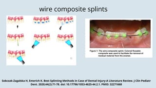 splinting-in-management-of-dental-trauma-in-primary-dentition-pdf