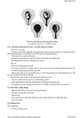 2.4.3. Thể nặng (Phong huyết tử cung – rau; Hội chứng Couvelaire)
Toàn thân và cơ năng
– Thường có biểu hiện nhiễm độc thai nghén nặng: phù to, protein niệu rất cao, nhưng huyết áp có
thể bình thường hoặc cao vừa, thậm chí có thể hạ (do có sốc nặng kèm theo).
– Thiếu máu rõ: da xanh tái, nhợt nhạt.
– Sốc nặng: tím, lạnh đầu chi, vã mồ hôi, khó thở, mạch nhanh, vật vã hoặc lơ mơ.
– Đau bụng dữ dội vùng hạ vị, thắt lưng, đau liên tục.
Thực thể
– Chiều cao tử cung tăng rất nhanh.
– Tử cung co cứng liên tục, không rõ cơn co, sờ tử cung cứng như gỗ, không nắn được phần thai nhi.
– Tim thai thường không nghe thấy (thai chết).
– Khám trong: thấy cổ tử cung thường cứng, có máu loãng đỏ hoặc đen, không đông theo tay. Nếu
đã vỡ ối, sẽ thấy nước ối lẫn máu loãng.
Cận lâm sàng: cần làm đầy đủ các thăm dò như đã đề cập ở trên.
– Siêu âm: có khối máu tụ sau rau to, tim thai không có nữa.
– Chức năng đông máu: máu chảy, máu đông kéo dài, fibrinogen máu giảm mạnh.
– Xét nghiệm nước tiểu: ngoài protein niệu cao, có thể thấy có trụ niệu, hồng cầu, bạch cầu,...
2.5. Tiến triển và biến chứng
– Băng huyết do đờ tử cung và rối loạn yếu tố đông máu.
– Suy thận, suy gan cấp và mạn tính.
– Mất tử cung.
– Tử vong mẹ rất cao, đặc biệt ở thể nặng do sốc, rối loạn tuần hoàn và nhiễm độc nặng.
– Thai suy và chết.
2.6. Hướng xử trí
2.6.1. Tuyến xã
– Tư vấn và chuyển tuyến.
Page 100 of 237
04/01/2013
file://C:WindowsTempjoytfbauqwcontent.htm
3125413
 