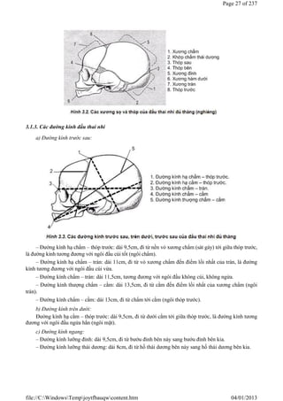 3.1.3. Các đường kính đầu thai nhi
a) Đường kính trước sau:
– Đường kính hạ chẩm – thóp trước: dài 9,5cm, đi từ nền vỏ xương chẩm (sát gáy) tới giữa thóp trước,
là đường kính tương đương với ngôi đầu cúi tốt (ngôi chẩm).
– Đường kính hạ chẩm – trán: dài 11cm, đi từ vỏ xương chẩm đến điểm lồi nhất của trán, là đường
kính tương đương với ngôi đầu cúi vừa.
– Đường kính chẩm – trán: dài 11,5cm, tương đương với ngôi đầu không cúi, không ngửa.
– Đường kính thượng chẩm – cằm: dài 13,5cm, đi từ cằm đến điểm lồi nhất của xương chẩm (ngôi
trán).
– Đường kính chẩm – cằm: dài 13cm, đi từ chẩm tới cằm (ngôi thóp trước).
b) Đường kính trên dưới:
Đường kính hạ cằm – thóp trước: dài 9,5cm, đi từ dưới cằm tới giữa thóp trước, là đường kính tương
đương với ngôi đầu ngửa hẳn (ngôi mặt).
c) Đường kính ngang:
– Đường kính lưỡng đỉnh: dài 9,5cm, đi từ bướu đỉnh bên này sang bướu đỉnh bên kia.
– Đường kính lưỡng thái dương: dài 8cm, đi từ hố thái dương bên này sang hố thái dương bên kia.
Page 27 of 237
04/01/2013
file://C:WindowsTempjoytfbauqwcontent.htm
 
