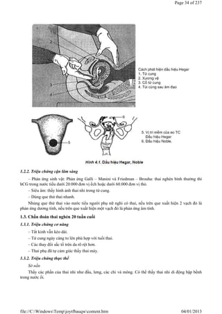 1.2.2. Triệu chứng cận lâm sàng
– Phản ứng sinh vật: Phản ứng Galli – Manini và Friedman – Brouha: thai nghén bình thường thì
hCG trong nước tiểu dưới 20.000 đơn vị ếch hoặc dưới 60.000 đơn vị thỏ.
– Siêu âm: thấy hình ảnh thai nhi trong tử cung.
– Dùng que thử thai nhanh.
Nhúng que thử thai vào nước tiểu người phụ nữ nghi có thai, nếu trên que xuất hiện 2 vạch đỏ là
phản ứng dương tính, nếu trên que xuất hiện một vạch đỏ là phản ứng âm tính.
1.3. Chẩn đoán thai nghén 20 tuần cuối
1.3.1. Triệu chứng cơ năng
– Tắt kinh vẫn kéo dài.
– Tử cung ngày càng to lên phù hợp với tuổi thai.
– Các thay đổi sắc tố trên da rõ rệt hơn.
– Thai phụ đã tự cảm giác thấy thai máy.
1.3.2. Triệu chứng thực thể
Sờ nắn
Thấy các phần của thai nhi như đầu, lưng, các chi và mông. Có thể thấy thai nhi di động bập bềnh
trong nước ối.
Page 34 of 237
04/01/2013
file://C:WindowsTempjoytfbauqwcontent.htm
 