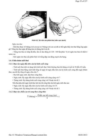 Nghe tim thai
– Khi thai được 4,5 tháng (với con rạ) và 5 tháng (với con so) đã có thể nghe thấy tim thai bằng ống nghe
gỗ. Tiếng tim thai nghe dễ dàng hơn từ tháng thứ 6 trở đi.
– Tiếng tim thai có nhịp độ đều, tần số dao động từ 120– 160 lần/phút. Vị trí nghe tim thai rõ nhất ở
mỏm vai.
– Khi nghe tim thai cần phân biệt với tiếng đập của động mạch chủ bụng.
1.4. Chẩn đoán tuổi thai
1.4.1. Dựa vào ngày đầu tiên của kỳ kinh cuối cùng
– Tính tuổi thai nhờ sử dụng lịch tính tuổi thai: bình thường thai đủ tháng có tuổi từ 38 đến 42 tuần.
– Tính tuổi thai bằng cách tính tổng số ngày từ ngày đầu tiên của kỳ kinh cuối cùng đến ngày khám
thai, sau đó lấy tổng số ngày chia cho 7.
– Dự tính ngày sinh: dựa theo công thức.
+ Ngày sinh: lấy ngày đầu tiên của kỳ kinh cuối cùng cộng với 7
+ Tháng sinh: lấy tháng kinh cuối cùng cộng với 9 hoặc trừ đi 3.
Nếu thai phụ nhớ ngày kinh theo lịch âm thì công thức dự tính ngày sinh như sau:
+ Ngày sinh: lấy ngày đầu tiên của kỳ kinh cuối cộng với 15.
+ Tháng sinh: lấy tháng kinh cuối cùng cộng với 9 hoặc trừ đi 3.
1.4.2. Dựa vào chiều cao tử cung theo công thức
Page 35 of 237
04/01/2013
file://C:WindowsTempjoytfbauqwcontent.htm
 