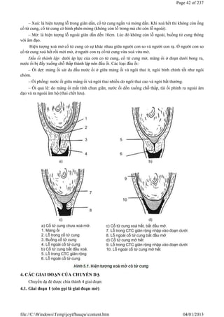– Xoá: là hiện tượng lỗ trong giãn dần, cổ tử cung ngắn và mỏng dần. Khi xoá hết thì không còn ống
cổ tử cung, cổ tử cung có hình phên mỏng (không còn lỗ trong mà chỉ còn lỗ ngoài).
– Mở: là hiện tượng lỗ ngoài giãn dần đến 10cm. Lúc đó không còn lỗ ngoài, buồng tử cung thông
với âm đạo.
Hiện tượng xoá mở cổ tử cung có sự khác nhau giữa người con so và người con rạ. Ở người con so
cổ tử cung xoá hết rồi mới mở, ở người con rạ cổ tử cung vừa xoá vừa mở.
Đầu ối thành lập: dưới áp lực của cơn co tử cung, cổ tử cung mở, màng ối ở đoạn dưới bong ra,
nước ối bị đẩy xuống chỗ thấp thành lập nên đầu ối. Các loại đầu ối:
– Ối dẹt: màng ối sát da đầu nước ối ở giữa màng ối và ngôi thai ít, ngôi bình chỉnh tốt như ngôi
chỏm.
– Ối phồng: nước ối giữa màng ối và ngôi thai nhiều do ngôi thai cao và ngôi bất thường.
– Ối quả lê: do màng ối mất tính chun giãn, nước ối dồn xuống chỗ thấp, túi ối phình ra ngoài âm
đạo và ra ngoài âm hộ (thai chết lưu).
4. CÁC GIAI ĐOẠN CỦA CHUYỂN DẠ
Chuyển dạ đẻ được chia thành 4 giai đoạn:
4.1. Giai đoạn 1 (còn gọi là giai đoạn mở)
Page 42 of 237
04/01/2013
file://C:WindowsTempjoytfbauqwcontent.htm
 