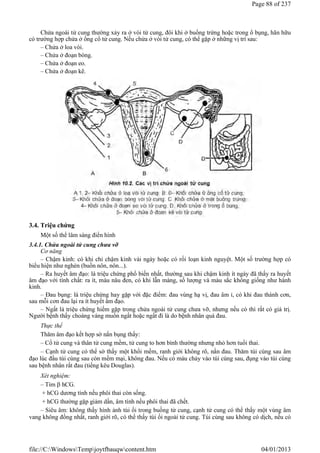 Chửa ngoài tử cung thường xảy ra ở vòi tử cung, đôi khi ở buồng trứng hoặc trong ổ bụng, hãn hữu
có trường hợp chửa ở ống cổ tử cung. Nếu chửa ở vòi tử cung, có thể gặp ở những vị trí sau:
– Chửa ở loa vòi.
– Chửa ở đoạn bóng.
– Chửa ở đoạn eo.
– Chửa ở đoạn kẽ.
3.4. Triệu chứng
Một số thể lâm sàng điển hình
3.4.1. Chửa ngoài tử cung chưa vỡ
Cơ năng
– Chậm kinh: có khi chỉ chậm kinh vài ngày hoặc có rối loạn kinh nguyệt. Một số trường hợp có
biểu hiện như nghén (buồn nôn, nôn...).
– Ra huyết âm đạo: là triệu chứng phổ biến nhất, thường sau khi chậm kinh ít ngày đã thấy ra huyết
âm đạo với tính chất: ra ít, màu nâu đen, có khi lẫn màng, số lượng và màu sắc không giống như hành
kinh.
– Đau bụng: là triệu chứng hay gặp với đặc điểm: đau vùng hạ vị, đau âm ỉ, có khi đau thành cơn,
sau mỗi cơn đau lại ra ít huyết âm đạo.
– Ngất là triệu chứng hiếm gặp trong chửa ngoài tử cung chưa vỡ, nhưng nếu có thì rất có giá trị.
Người bệnh thấy choáng váng muốn ngất hoặc ngất đi là do bệnh nhân quá đau.
Thực thể
Thăm âm đạo kết hợp sờ nắn bụng thấy:
– Cổ tử cung và thân tử cung mềm, tử cung to hơn bình thường nhưng nhỏ hơn tuổi thai.
– Cạnh tử cung có thể sờ thấy một khối mềm, ranh giới không rõ, nắn đau. Thăm túi cùng sau âm
đạo lúc đầu túi cùng sau còn mềm mại, không đau. Nếu có máu chảy vào túi cùng sau, đụng vào túi cùng
sau bệnh nhân rất đau (tiếng kêu Douglas).
Xét nghiệm:
– Tìm  hCG.
+ hCG dương tính nếu phôi thai còn sống.
+ hCG thường gặp giảm dần, âm tính nếu phôi thai đã chết.
– Siêu âm: không thấy hình ảnh túi ối trong buồng tử cung, cạnh tử cung có thể thấy một vùng âm
vang không đồng nhất, ranh giới rõ, có thể thấy túi ối ngoài tử cung. Túi cùng sau không có dịch, nếu có
Page 88 of 237
04/01/2013
file://C:WindowsTempjoytfbauqwcontent.htm
 