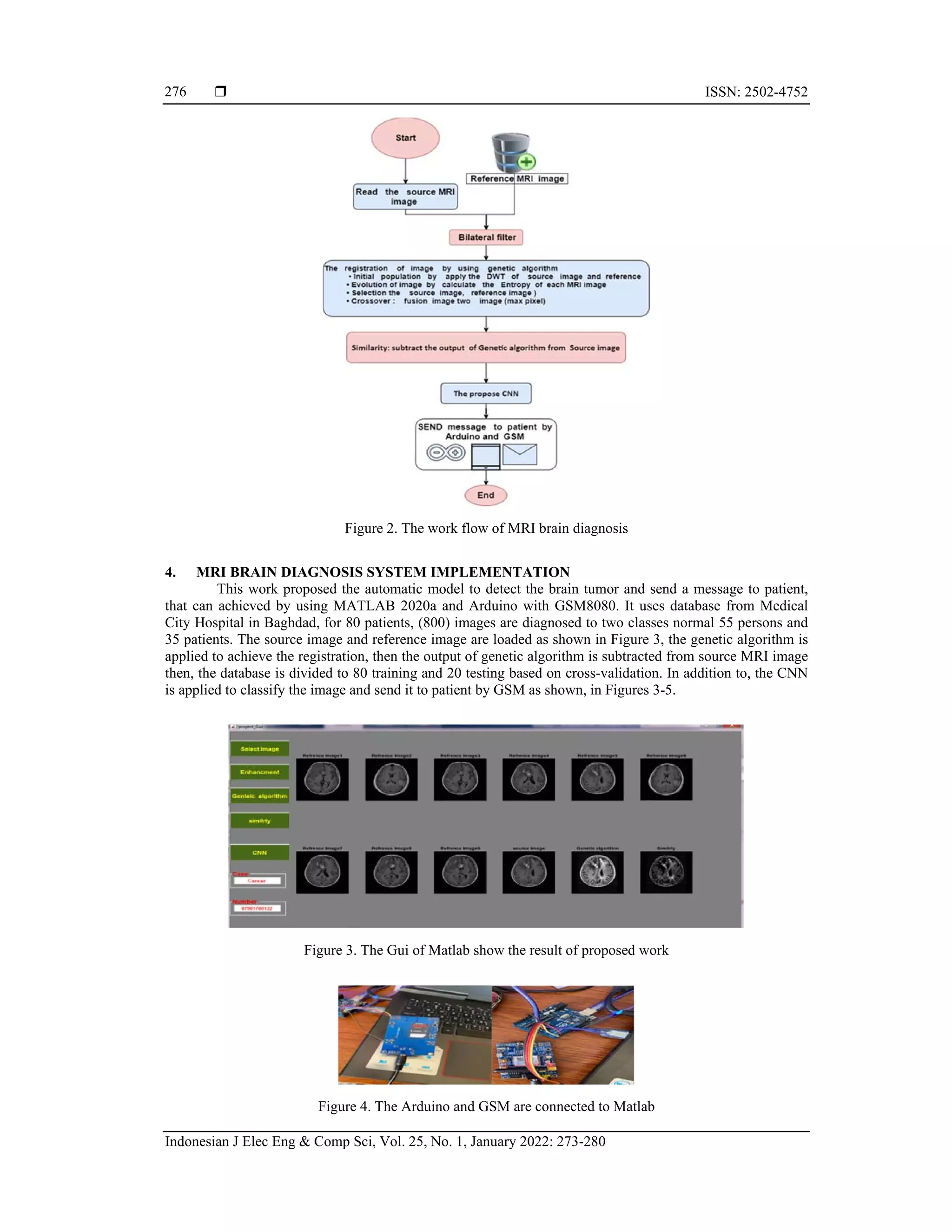 The IoT and registration of MRI brain diagnosis based on genetic ...