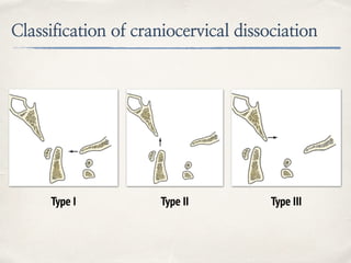 Classification of craniocervical dissociation
Type I Type II Type III
 