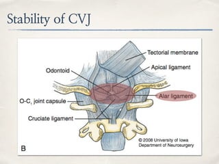Stability of CVJ
 
