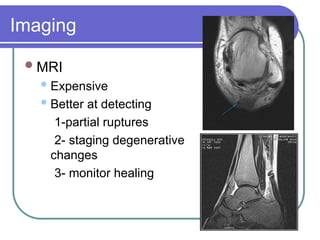 Ta Rupture rupture-Achilles-Tendon and management-ppt.ppt