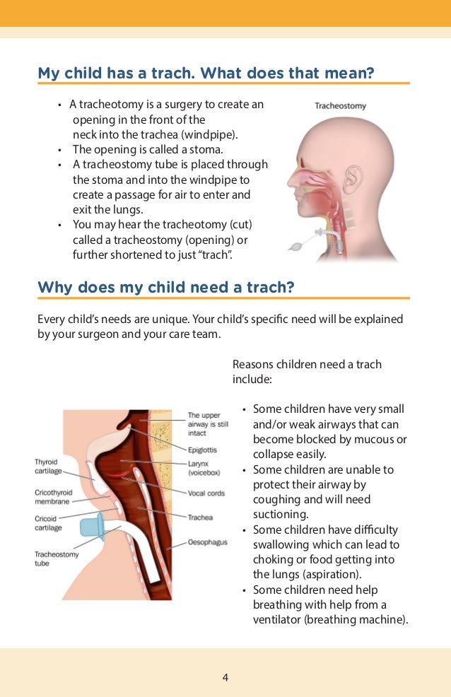 What You Need to Know About Your Child's Tracheostomy