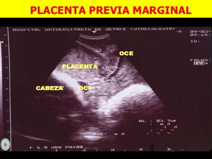 Ecografia en emergencias gineco obstetricas 2 - CICAT-SALUD Ecografia en emergencias gineco obstetricas 2 - CICAT-SALUD