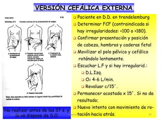 VERSIÓN CEFÁLICA EXTERNA
                                    Paciente en D.D. en trendelemburg
                                    Determinar FCF (contraindicada si
                                     hay irregularidades: <100 o >180).
                                    Confirmar presentación y posición
                                     de cabeza, hombros y caderas fetal
                                    Movilizar el polo pélvico y cefálico
                                     rotándolo lentamente.
                                    Escuchar L.F y si hay irregularid.:
                                         D.L.Izq.
                                         O2 4-6 L/min.
                                         Revaluar c/15´.
                                    Permanecer acostada x 15´. Si no da
                                     resultado;
                                     Nuevo intento con movimiento de ro-
No realizar antes de las 37 s. y
      Si no dispone de S.O.
  12/10/2012                             tación hacia atrás.
                                jraguilarf @gmail.com                  19
 