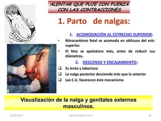 ALENTAR QUE PUJE CON FUERZA
                      CON LAS CONTRACCIONES

                      1. Parto de nalgas:
                            1. ACOMODACIÓN AL ESTRECHO SUPERIOR:
                      •   Bitrocantéreo fetal se acomoda en oblicuos del estr.
                          superior.
                      •   El feto se apelotona más, antes de reducir sus
                          diámetros.
                                2. DESCENSO Y ENCAJAMIENTO:
                       Es lento y laborioso
                       La nalga posterior desciende más que la anterior
                       Las C.U. favorecen éste mecanismo




        Visualización de la nalga y genitales externos
                         masculinos.
12/10/2012                 jraguilarf @gmail.com                           26
 