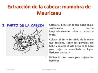 Extracción de la cabeza: maniobra de
                Mauriceau

3. PARTO DE LA CABEZA • Colocar al bebé con la cara hacia abajo,
                                     sosteniendo        el       cuerpo
                                     longitudinalmente sobre su mano y
                                     brazo.
                                •    Colocar el 1er y 3er dedo de la mano
                                     que sostiene, sobre los pómulos del
                                     bebé y colocar el 2do dedo en la boca
                                     para bajar la mandíbula y lograr
                                     flexionar la cabeza.
                                •    Utilizar la otra mano para sujetar los
                                     hombros


  12/10/2012               jraguilarf @gmail.com                        37
 