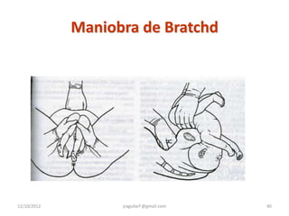Maniobra de Bratchd




12/10/2012         jraguilarf @gmail.com   40
 