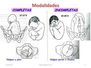 Modalidades
         COMPLETAS                               INCOMPLETAS
             12-15 %                                85-88 %




 Nalgas y pies                            Nalgas puras o franca

12/10/2012               jraguilarf @gmail.com                    5
 