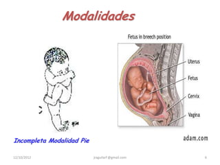 Modalidades




Incompleta Modalidad Pie

12/10/2012                 jraguilarf @gmail.com   6
 