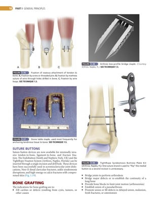 campbell’s operative orthopaedics 14th edition Frederick M.Azar