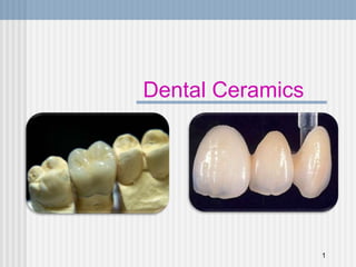 Dental Ceramics
1
 