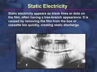 Static Electricity
Static electricity appears as black lines or dots on
the film, often having a tree-branch appearance. It is
caused by removing the film from the box or
cassette too quickly, creating static discharge.
 