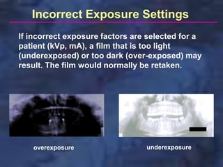 Incorrect Exposure Settings
If incorrect exposure factors are selected for a
patient (kVp, mA), a film that is too light
(underexposed) or too dark (over-exposed) may
result. The film would normally be retaken.




   overexposure                  underexposure
 