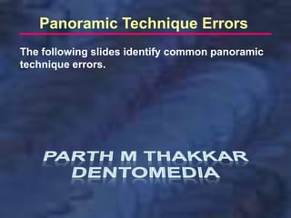 Panoramic Technique Errors
The following slides identify common panoramic
technique errors.
 