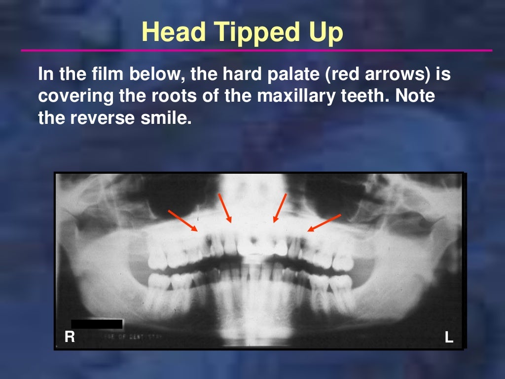panoramictechique errors