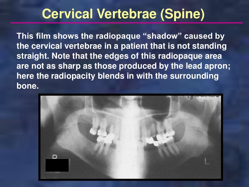 panoramictechique errors