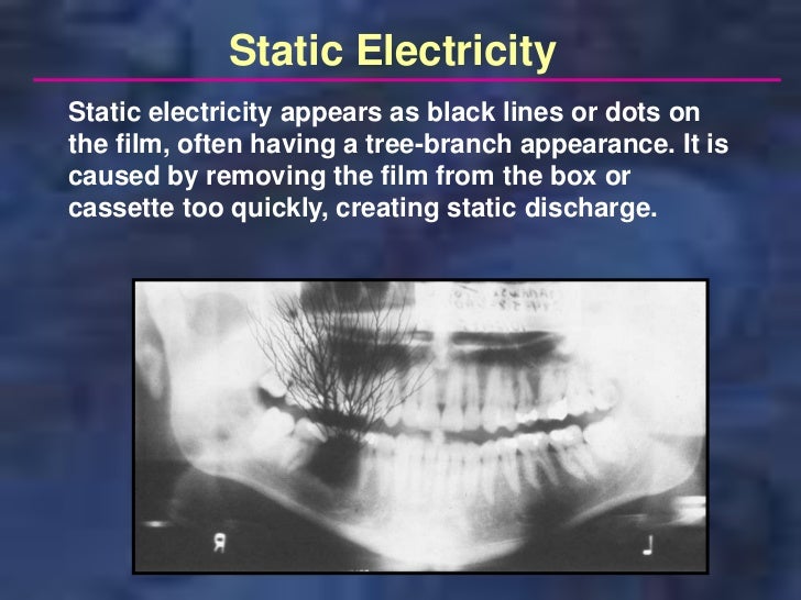 panoramictechique errors