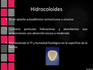 Hidrocoloides
• Es un apósito autoadhesivo semioclusivo u oclusivo
• Contiene partículas hidroactivas y absorbentes que
proporcionan una absorción escasa a moderada
• Manteniendo la Tº y humedad fisiológica en la superficie de la
herida.
 
