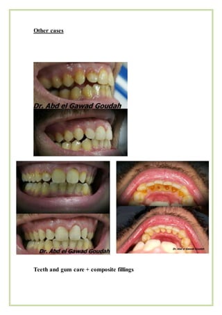 Other cases
Teeth and gum care + composite fillings
 