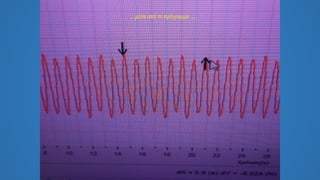 … μέσα από το πρόγραμμα ...
 