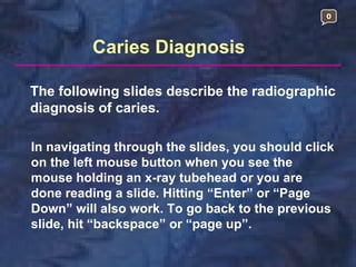 0



          Caries Diagnosis

The following slides describe the radiographic
diagnosis of caries.

In navigating through the slides, you should click
on the left mouse button when you see the
mouse holding an x-ray tubehead or you are
done reading a slide. Hitting “Enter” or “Page
Down” will also work. To go back to the previous
slide, hit “backspace” or “page up”.
 